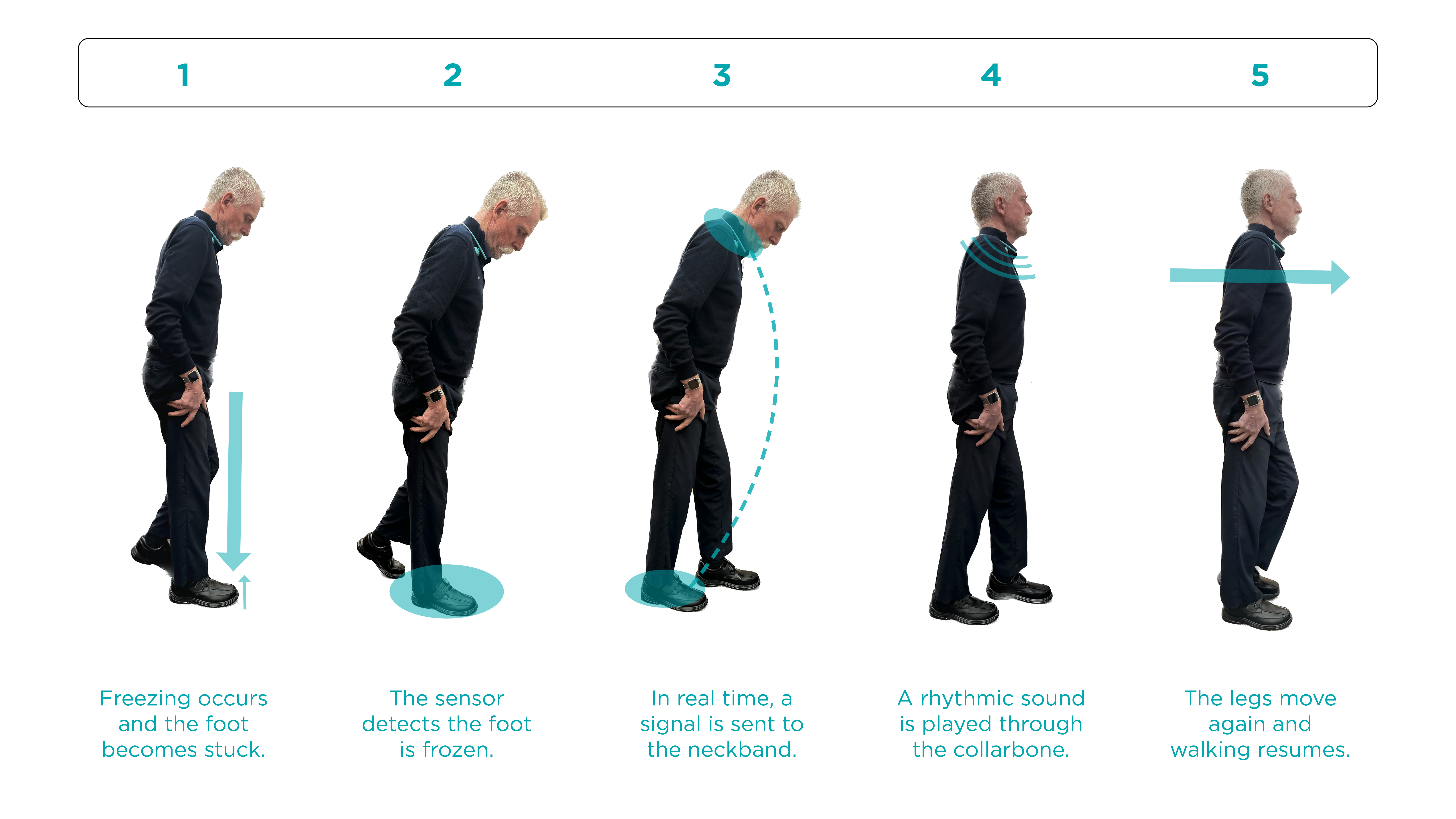 An image with a caption of: Peter tracks when your legs stop working and in real-time plays a signal to help them move.