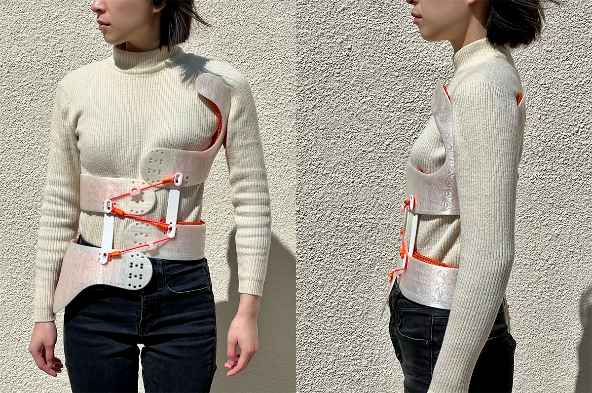 Airy scoliosis brace